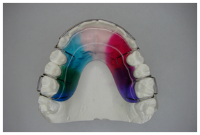 aparat ortodontyczny ruchomy